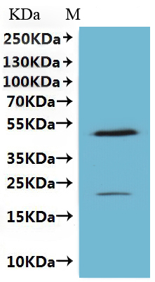 Recombinant Human Claudin-18.2 (CLDN18.2), Fluorescent-VLPs (Active)