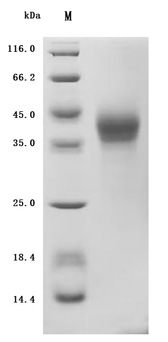 Recombinant Human Leukemia inhibitory factor (LIF) (Active)