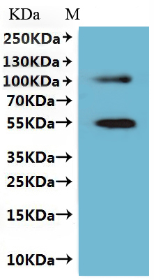 Recombinant Human Claudin-6 (CLDN6), Fluorescent-VLPs (Active)