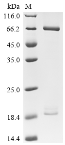 Recombinant Human Proprotein convertase subtilisin/kexin type 9 (PCSK9) (D374Y), Biotinylated (Active)