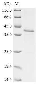 Recombinant Hepatitis B virus genotype D subtype ayw Large envelope protein (S)
