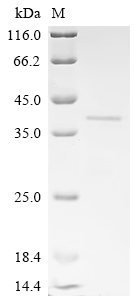 Recombinant Mouse Platelet endothelial aggregation receptor 1 (Pear1), partial