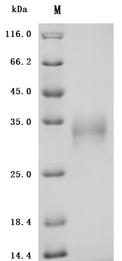 Recombinant Human Tumor necrosis factor ligand superfamily member 15 (TNFSF15) (Active)