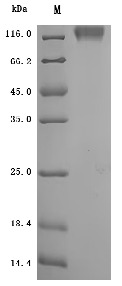 Recombinant Macaca mulatta Carcinoembryonic antigen-related cell adhesion molecule 5 (CEACAM5), partial (Active)