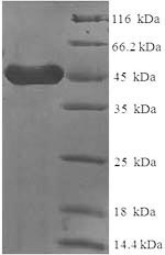 Human FCER2 protein