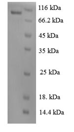Human VEGFR2 protein