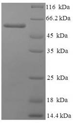 Human PABPC1 protein
