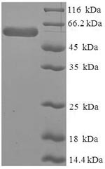 Human SERPINB1 protein