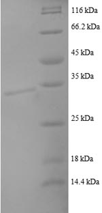 Human CCL22 protein