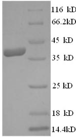 Human VEGF-D protein