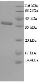 Recombinant Salmonella typhi Outer membrane protein A (ompA)