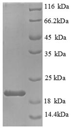 Mouse Il1b protein