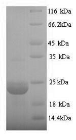 Yeast yoaJ protein