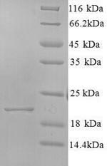 Yeast Core protein