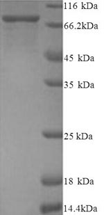 Yeast PADI2 protein
