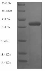Human Collagen IV protein