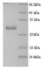 Yeast nosM protein