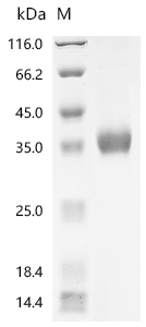 Recombinant Human Calcitonin gene-related peptide 1 (CALCA), partial