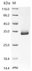 Recombinant Human Calcitonin gene-related peptide 1 (CALCA), partial