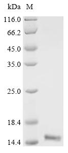 Recombinant Mouse Fatty acid-binding protein, adipocyte (Fabp4)