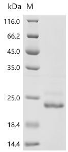Recombinant Chlamydia pneumoniae Large cysteine-rich periplasmic protein OmcB (omcB), partial