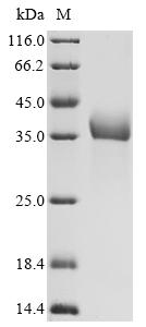 Recombinant Rat Progonadoliberin-1(Gnrh1)