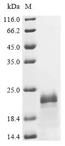 Recombinant Hepatitis delta virus genotype I Small delta antigen