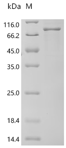 Recombinant Human RAF proto-oncogene serine/threonine-protein kinase (RAF1)