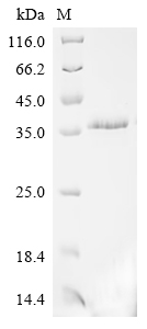 Recombinant Human B-lymphocyte antigen CD20 (MS4A1)-Detergent (Active)