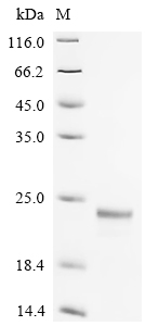 Recombinant Mouse Fatty acid-binding protein, adipocyte (Fabp4)