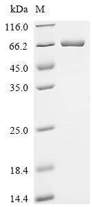 Recombinant Human Programmed cell death protein 4 (PDCD4)