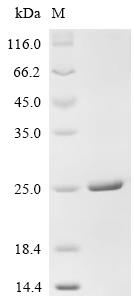 Recombinant Human Calcitonin gene-related peptide 1 (CALCA), partial