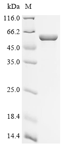 Recombinant Human Keratin, type I cytoskeletal 18 (KRT18)
