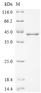 Recombinant Human L-lactate dehydrogenase A chain (LDHA)