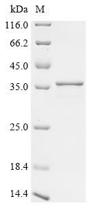 Recombinant Hepatitis delta virus genotype II Large delta antigen