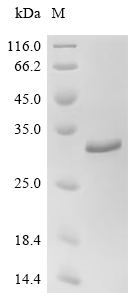 Recombinant Chlamydia pneumoniae Large cysteine-rich periplasmic protein OmcB (omcB), partial