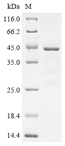 Recombinant Human C-C motif chemokine 21 (CCL21)