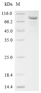 Recombinant Hepatitis B virus genotype D subtype ayw Protein P (P), partial, Biotinylated
