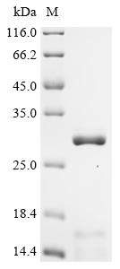 Recombinant Human Metaxin-1 (MTX1), partial