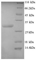 Recombinant Human Calcitonin gene-related peptide 1 (CALCA), partial