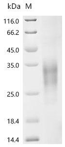 Recombinant Human B-cell antigen receptor complex-associated protein beta chain (CD79B), partial (Active)