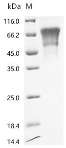 Recombinant Human Ly6/PLAUR domain-containing protein 3 (LYPD3) (Active)
