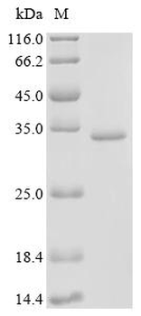 Recombinant Human 28S rRNA (cytosine(4447)-C(5))-methyltransferase (NOP2), partial