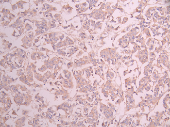 HSPA5 Antibody