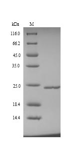 Human TIMP-4 protein