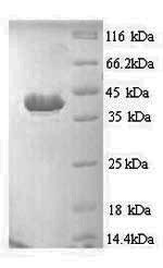 Human APAF1 protein