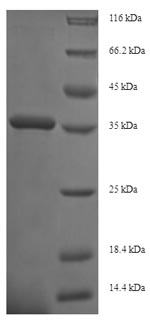 Human ITGA2 protein