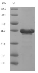 Human UL111A protein