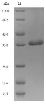 Human SLC1A1 protein