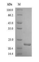 Human ITGA2 protein